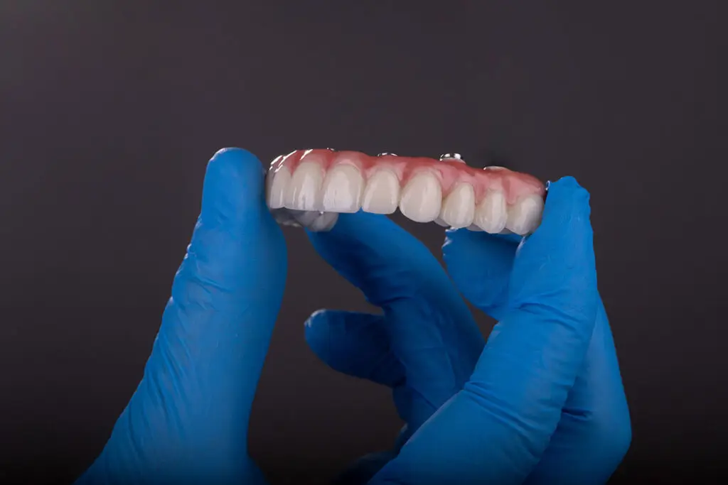 All-on-X Fixed Implants in Trinity: Temporary Teeth vs. Your Final Full-Arch Smile